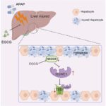 EGCG in APAP-induced liver injury