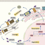Therapeutic strategies targeting SREBP transcription factors